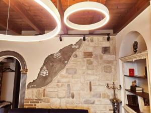 Albenza Bnb