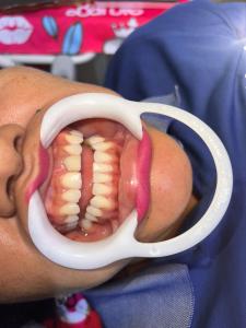 Castillo Yarinacocha