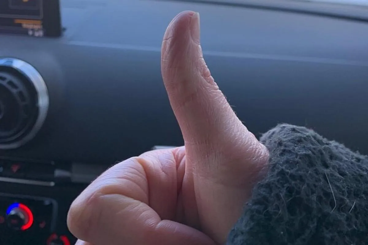 Rallye Voiture Insolite autour des Lacs Vosgiens – photo 19
