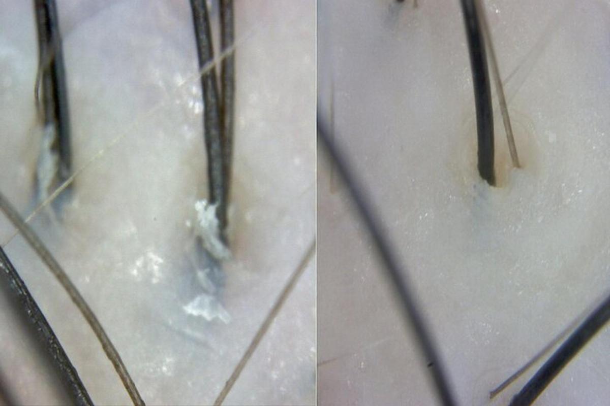 hai bức ảnh của một cặp gậy trượt tuyết trên sàn nhà