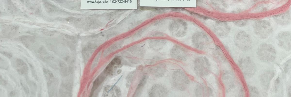 a drawing of the inside of a stomach with a red cord
